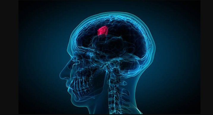 შექმნეს ცხვირის წვეთები, რომელიც თავის ტვინის ყველაზე აგრესიულ კიბოს ებრძვის